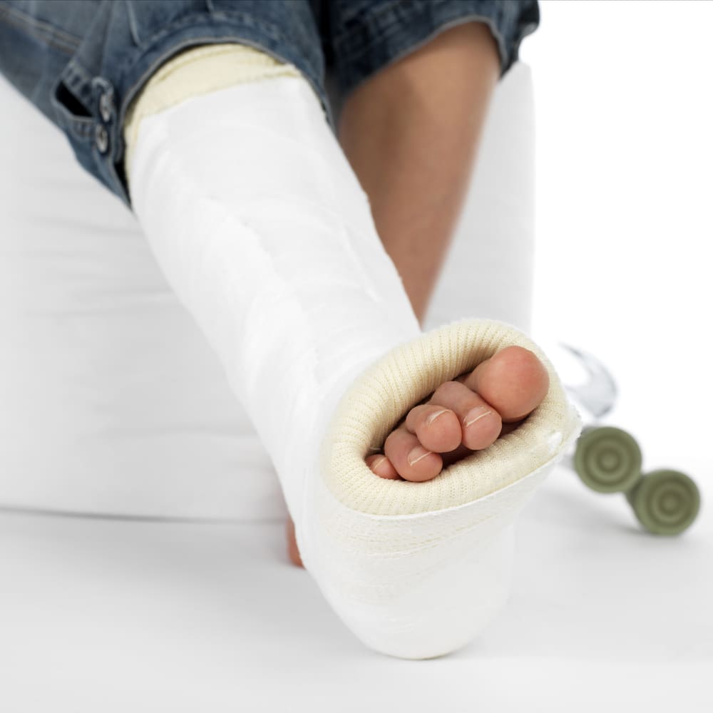Letsel - voet in het gips